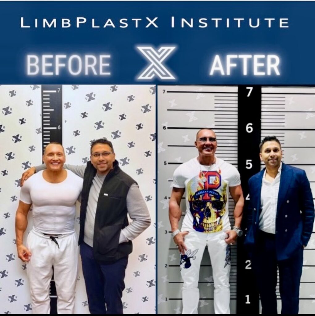 He Broke His Legs to Get Taller. And He's Not Done Yet-2